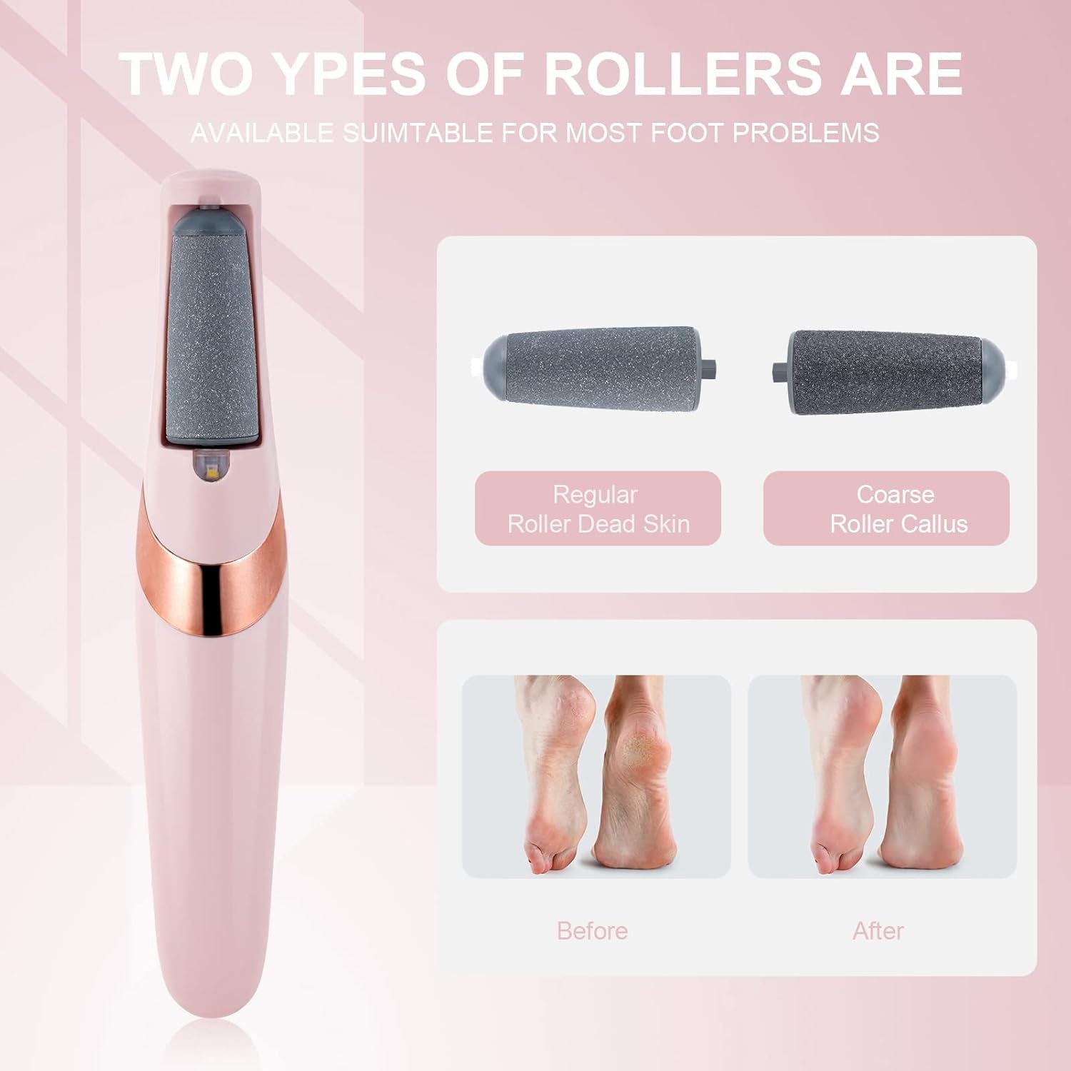 Rechargeable Electric Foot File Callus Remover