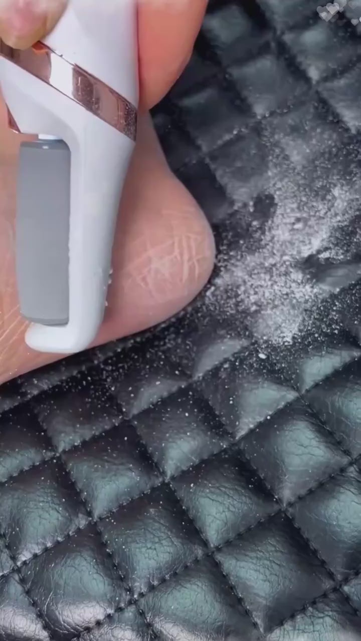 Rechargeable Electric Foot File Callus Remover
